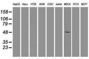 Image no. 2 for anti-Forkhead Box A1 (FOXA1) antibody (ABIN1498292) (FOXA1 antibody)