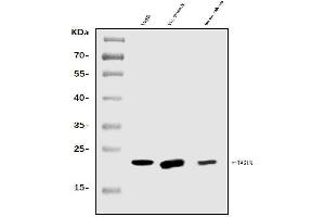 Western blot analysis of TAGLN/Transgelin using anti-TAGLN/Transgelin antibody (ABIN7600099). (Transgelin antibody  (AA 15-170))