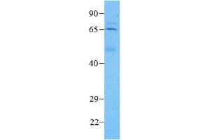 Host:  Rabbit  Target Name:  MEIS2  Sample Type:  T-OV (Tumor-Ovary)  Antibody Dilution:  3. (MEIS2 antibody  (N-Term))
