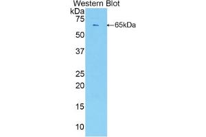 Western blot analysis of the recombinant protein. (ESM1 antibody  (AA 22-184))