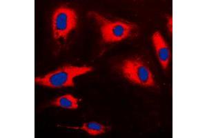 Immunofluorescent analysis of CARD14 staining in HeLa cells. (CARD14 antibody  (Center))
