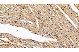 Detection of HIF1a in Rat Cardiac Muscle Tissue using Polyclonal Antibody to Hypoxia Inducible Factor 1 Alpha (HIF1a) (HIF1A antibody  (AA 216-336))