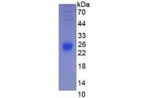 Image no. 1 for Interleukin 2 (IL2) (AA 21-169) (Active) protein (His tag) (ABIN6239755) (IL-2 Protein (AA 21-169) (His tag))