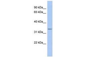 Image no. 1 for anti-Outer Dense Fiber of Sperm Tails 4 (ODF4) (N-Term) antibody (ABIN6743718) (ODF4 antibody  (N-Term))