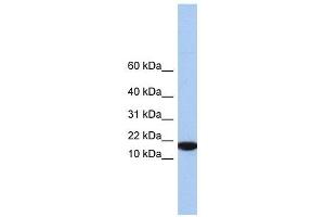 IL5 antibody used at 1 ug/ml to detect target protein. (IL-5 antibody)