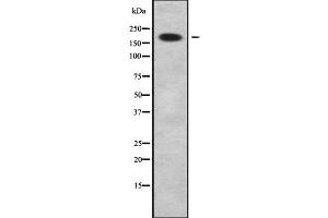 Western blot analysis of ABCC9 using HeLa whole cell lysates