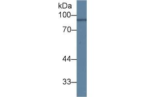 Detection of ANG in Mouse Brain lysate using Polyclonal Antibody to Angiostatin (ANG) (Angiostatin antibody  (AA 79-466))