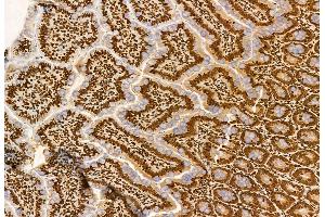 ABIN6259966 and ABIN6272936 at 1/100 staining Rat colon tissue by IHC-P.