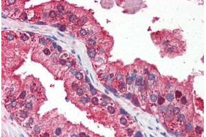 Human Prostate (formalin-fixed, paraffin-embedded) stained with DRAM antibody ABIN351449 at 3 ug/ml followed by biotinylated goat anti-rabbit IgG secondary antibody ABIN481713, alkaline phosphatase-streptavidin and chromogen. (DRAM antibody  (N-Term))