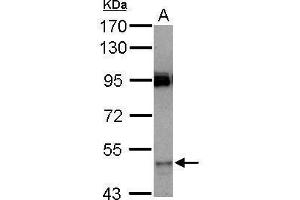 WB Image Sample (30 ug of whole cell lysate) A: HeLa 7. (CYP3A7 antibody  (Center))