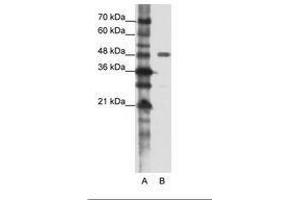 Image no. 1 for anti-Protein Phosphatase 1, Regulatory Subunit 8 (PPP1R8) (AA 91-140) antibody (ABIN202315) (PPP1R8 antibody  (AA 91-140))