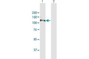 Western Blot analysis of RNF111 expression in transfected 293T cell line by RNF111 MaxPab polyclonal antibody. (RNF111 antibody  (AA 1-985))