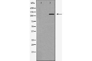 Western blot analysis of Integrin αE expression in HepG2 cells,The lane on the left is treated with the antigen-specific peptide. (CD103 antibody  (N-Term))