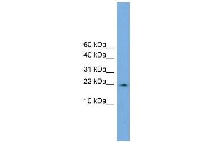 WB Suggested Anti-PPIL3  Antibody Titration: 0. (PPIL3 antibody  (Middle Region))