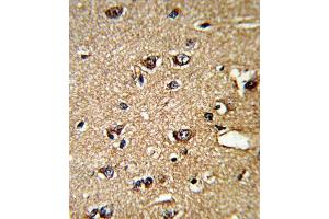 Immunohistochemistry (IHC) image for anti-Peptidylprolyl Isomerase A (Cyclophilin A) (PPIA) antibody (ABIN3001732)