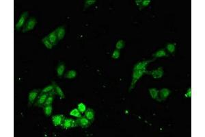 Immunofluorescent analysis of HepG2 cells using ABIN7166533 at dilution of 1:100 and Alexa Fluor 488-congugated AffiniPure Goat Anti-Rabbit IgG(H+L) (FAT3 antibody  (AA 1209-1470))