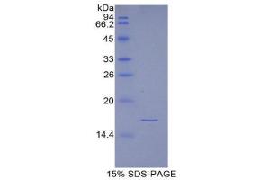 SDS-PAGE (SDS) image for Inhibin, alpha (INHA) (AA 233-366) protein (His tag) (ABIN1079904) (Inhibin alpha Protein (AA 233-366) (His tag))