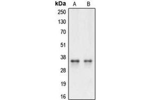 Western blot analysis of Caspase 3 expression in HeLa (A), Raw264. (Caspase 3 antibody  (Center))