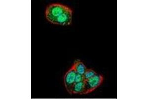 Confocal immunofluorescent analysis of Nucleolin Antibody (Center) Cat. (Nucleolin antibody  (Middle Region))