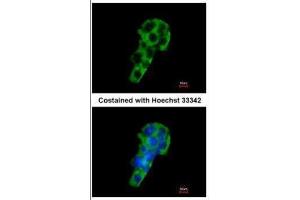 ICC/IF Image Immunofluorescence analysis of methanol-fixed HepG2, using PIGR, antibody at 1:200 dilution.