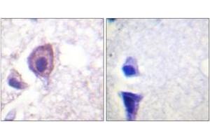 Immunohistochemistry analysis of paraffin-embedded human brain tissue, using CD4 (Ab-433) Antibody. (CD4 antibody  (AA 401-450))