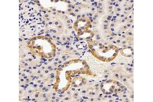 Immunohistochemistry analysis of paraffin-embedded rat kidney using,TRPV5 (ABIN7075977) at dilution of 1: 600 (TRPV5 antibody)