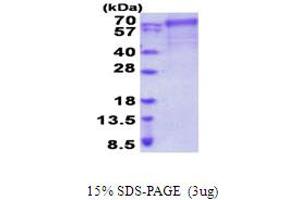 SDS-PAGE (SDS) image for Phenylalanyl-tRNA Synthetase, beta Subunit (FARSB) (AA 1-589) protein (His tag) (ABIN5854073) (FARSB Protein (AA 1-589) (His tag))