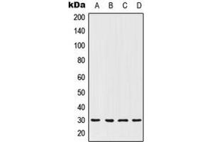 Western blot analysis of HOXC12 expression in MCF7 (A), ACHN (B), NIH3T3 (C), PC12 (D) whole cell lysates. (HOXC12 antibody  (Center))