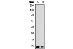 Western blot analysis of UBCH5 expression in SW620 (A), BT474 (B) whole cell lysates. (UBE2D1 antibody)