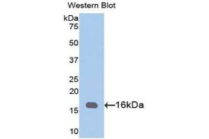 Western blot analysis of the recombinant protein. (PHPT1 antibody  (AA 1-124))