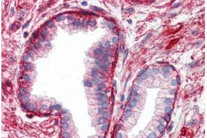 Human Prostate (formalin-fixed, paraffin-embedded) stained with ITGB1 antibody ABIN364254 at 10 ug/ml followed by biotinylated anti-mouse IgG secondary antibody ABIN481714, alkaline phosphatase-streptavidin and chromogen. (ITGB1 antibody)