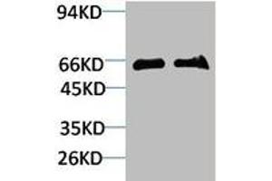 Western blot analysis of 1) Mouse Brain Tissue, 2)Rat Brain Tissue with GABA Transporter 1 Rabbit pAb diluted at 1:2,000. (SLC6A1 antibody)