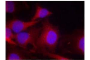 Image no. 2 for anti-Phospholipase C gamma 2 (PLCG2) (Tyr753) antibody (ABIN197402) (Phospholipase C gamma 2 antibody  (Tyr753))