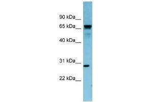 WB Suggested Anti-RASL12 Antibody Titration: 0. (RASL12 antibody  (N-Term))