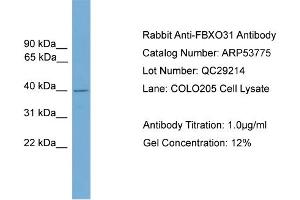 WB Suggested Anti-FBXO31  Antibody Titration: 0.