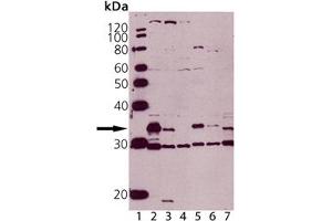 Western blot analysis of Caspase-3 pAb: Lane 1: MW Marker, Lane 2: Jurkat , Lane 3: Jurkat treated with staurosporine, Lane 4: MCF-7 (negative control), Lane 5: HeLa, (cell lysate) , Lane 6: Rat Spleen, Lane 7: Mouse Spleen. (Caspase 3 antibody)