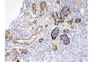 Immunohistochemistry (IHC) image for anti-UDP-Galactose-4-Epimerase (GALE) (AA 1-340) antibody (ABIN5693266)