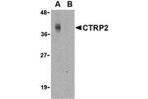 Western Blotting (WB) image for anti-C1q and Tumor Necrosis Factor Related Protein 2 (C1QTNF2) (N-Term) antibody (ABIN1031331) (C1QTNF2 antibody  (N-Term))