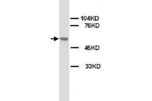 Western Blot analysis of CHRNA1 expression from rat skeletal muscle lyate with CHRNA1 polyclonal antibody . (CHRNA1 antibody  (N-Term))