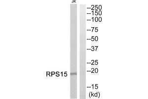 Western blot analysis of extracts from Jurkat cells, using RPS15 antibody.