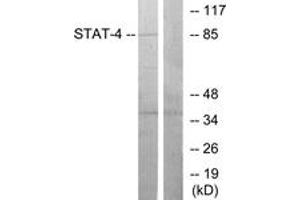 Western blot analysis of extracts from HeLa cells, using STAT4 (Ab-693) Antibody.