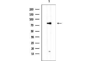anti-Radial Spoke Head 4 Homolog A (RSPH4A) antibody