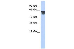 BLMH antibody used at 1 ug/ml to detect target protein. (BLMH antibody  (Middle Region))