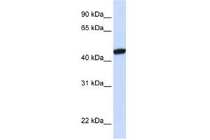 KRR1 antibody used at 1 ug/ml to detect target protein. (KRR1 antibody  (C-Term))