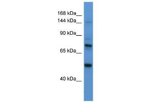 WB Suggested Anti-ASTN2 Antibody Titration:  0. (Astrotactin 2 antibody  (N-Term))