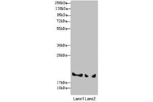 Western blot All lanes: BLOC1S6 antibody at 3. (Pallidin antibody  (AA 1-170))