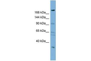 WB Suggested Anti-DIP2A Antibody Titration:  0. (DIP2A antibody  (N-Term))
