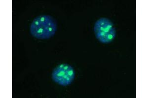 anti-Poly A Specific Ribonuclease (PARN) (AA 1-301) antibody