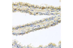 Immunohistochemistry of paraffin-embedded human prostate using GPLD1 antibody at dilution of 1:100 (40x lens). (GPLD1 antibody)