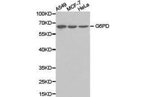 Western Blotting (WB) image for anti-Glucose-6-Phosphate Dehydrogenase (G6PD) antibody (ABIN1872757) (Glucose-6-Phosphate Dehydrogenase antibody)